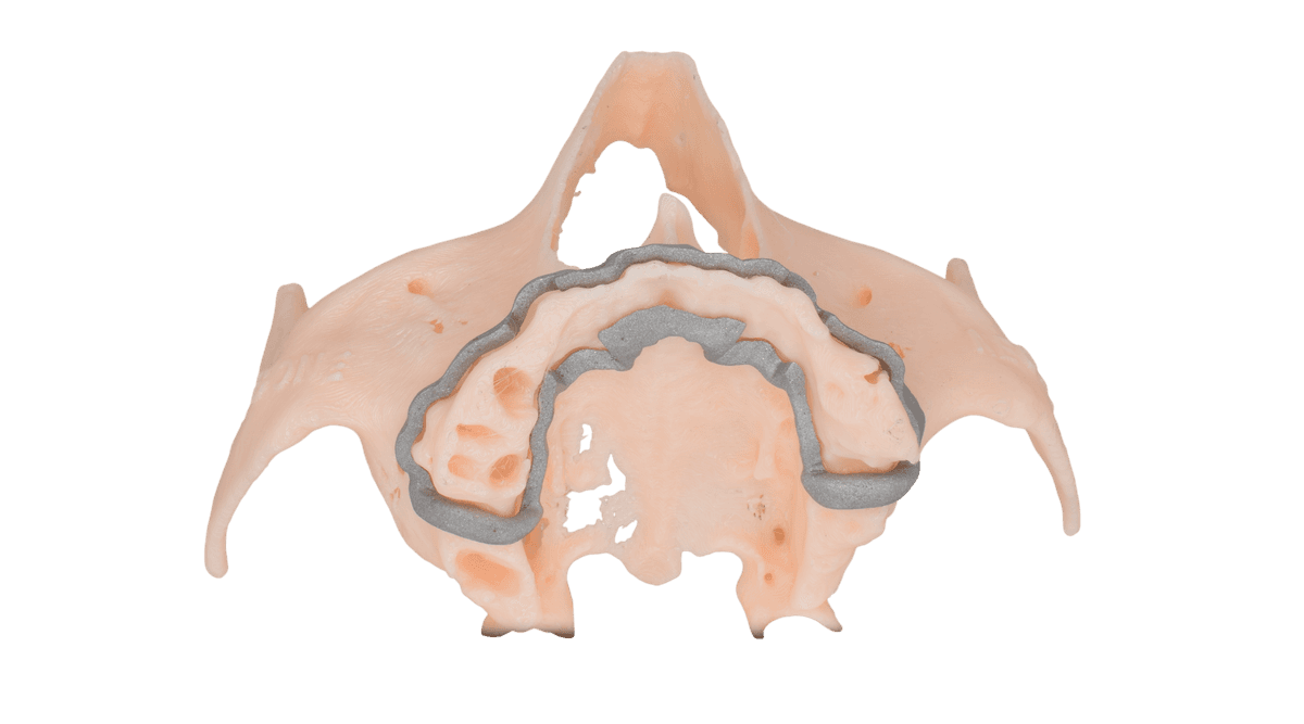 Plateacuing & Slots Preparation Guide